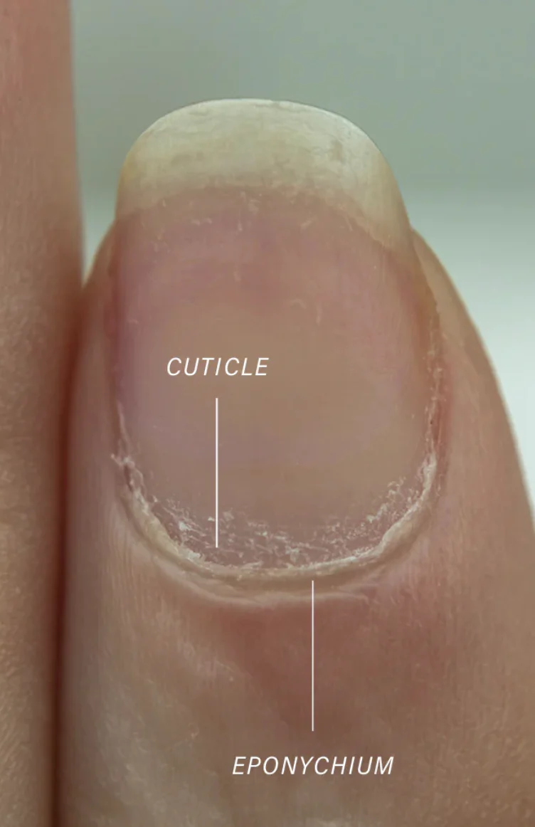Cuticle Treatment Only